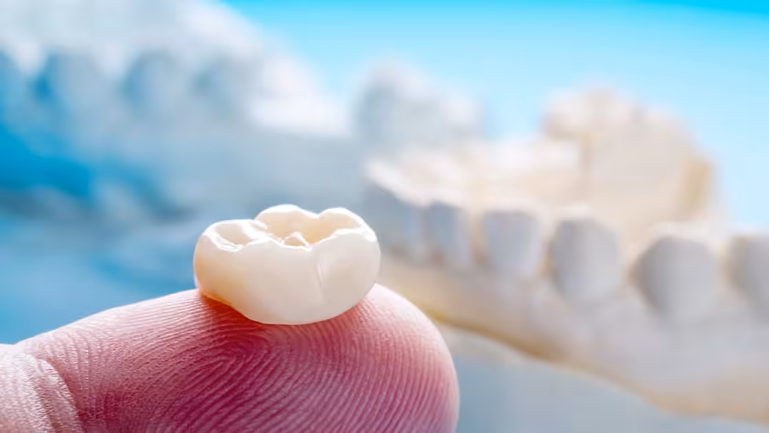 Dental Crown